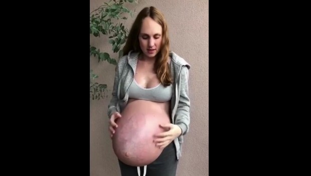 WOW: enceinte de triplés, elle dévoile la forme surprenante de son ventre  (vidéo)