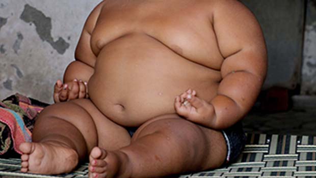 obésité infantile