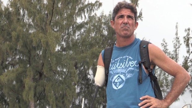 Rodolphe Arrieguy - Surfeur - Attaque requin - Un an après - Saint-Leu - La Réunion