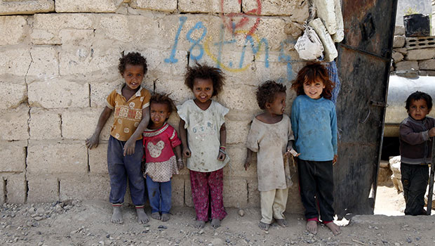 Guerre Yémen - Malnutrition des enfants
